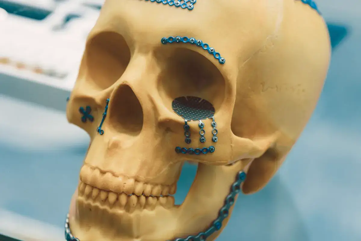 Cirurgia e Traumatologia Bucomaxilofacial